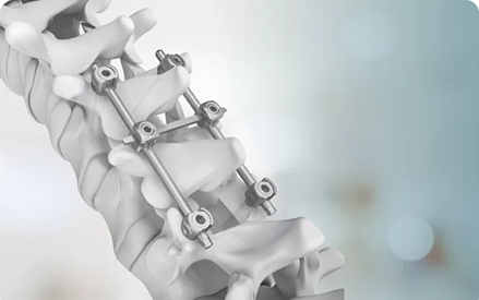 Desempenho e usos de materiais de liga de titânio, como hastes médicas de titânio.